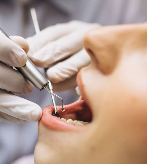 Most Commonly Asked Dental Questions