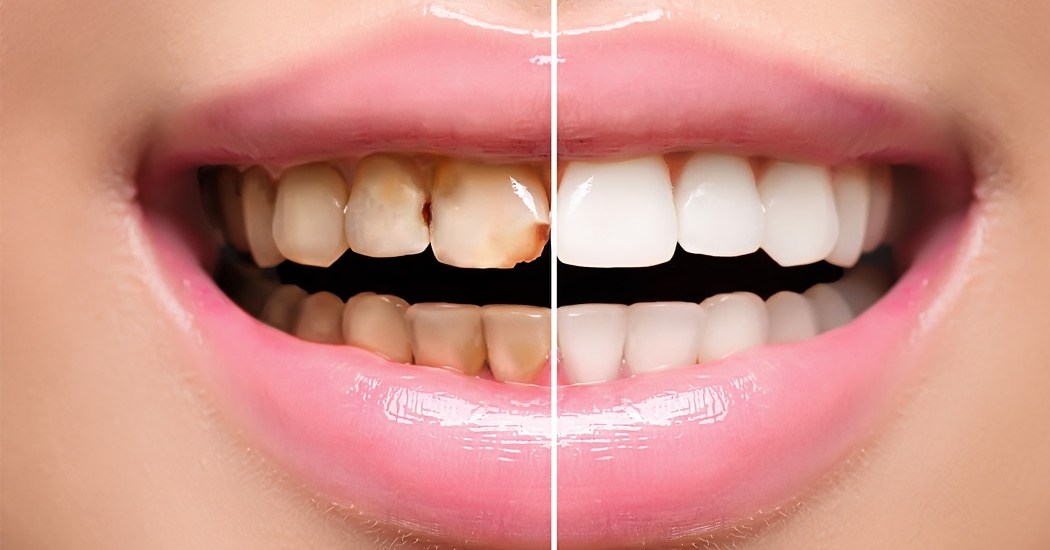 Cosmetic Dentistry