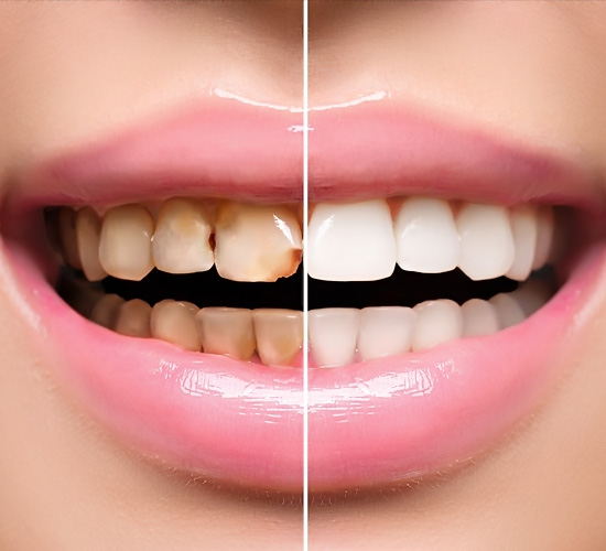 Cosmetic Dentistry